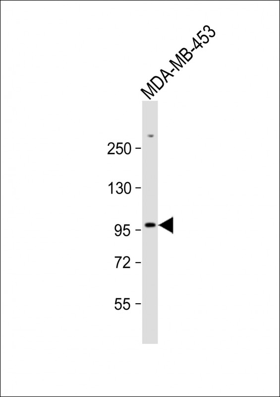 ZBTB49 Antibody