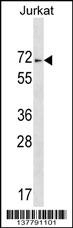 ZNF613 Antibody