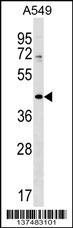 ZNF25 Antibody