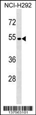 ATP6V1C2 Antibody
