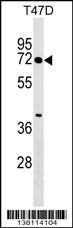 ZNF563 Antibody