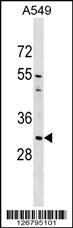 AQP1 Antibody