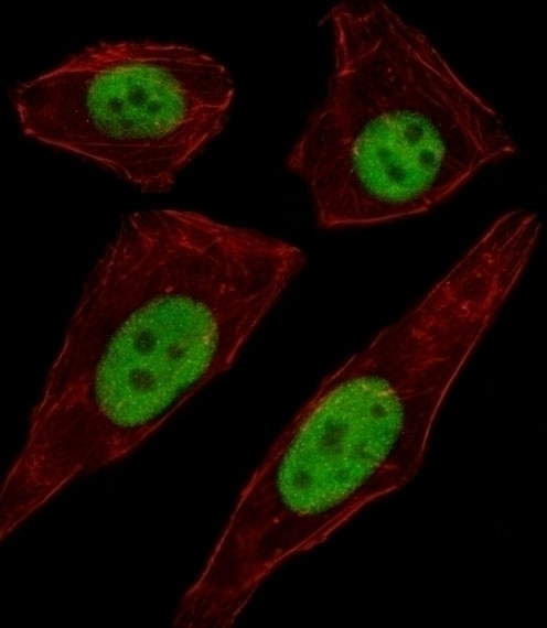 TFAP2D Antibody