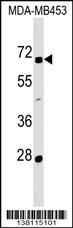 ZNF565 Antibody
