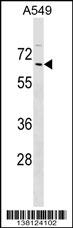 ZNF675 Antibody