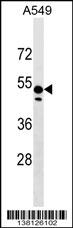 ZNF695 Antibody