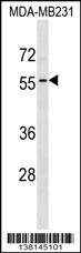 ADAT1 Antibody