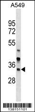ARMC1 Antibody