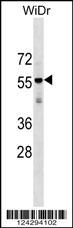 AGPAT9 Antibody