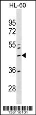 ZNF589 Antibody