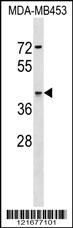 ARSA Antibody
