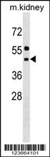 ALG11 Antibody