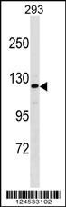 AFF2 Antibody