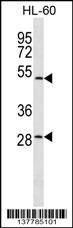 ZNF324 Antibody