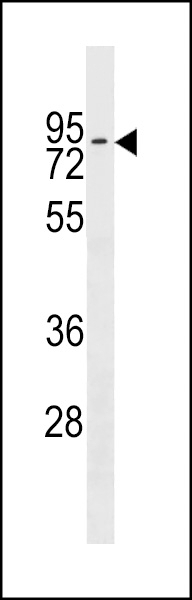 ZNF551 Antibody