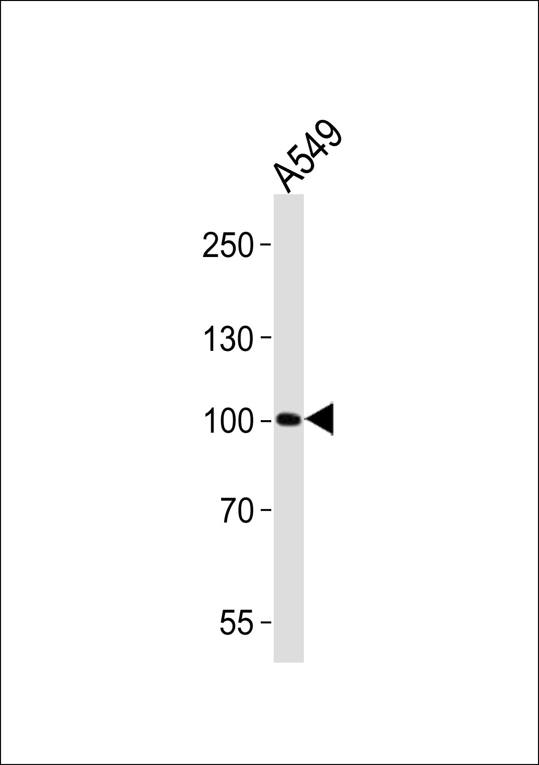 ZNF287 Antibody