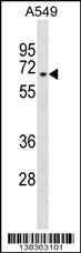 ZNF319 Antibody