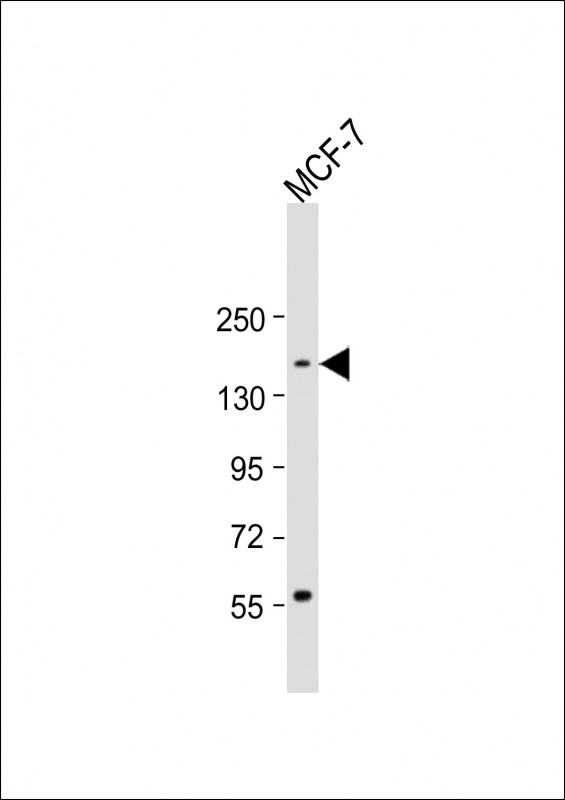ADNP Antibody