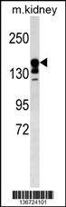 ABCC9 Antibody