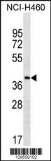 ZNF488 Antibody