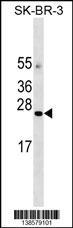 AGTRAP Antibody