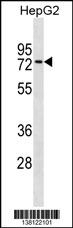 ZNF614 Antibody