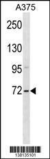 ZSWIM2 Antibody