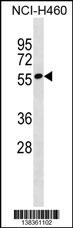 ZNF302 Antibody