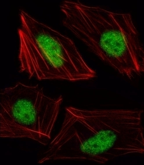 TBX15 Antibody