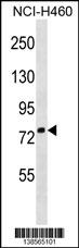 ZNF607 Antibody