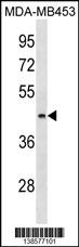 ALG8 Antibody