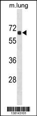 ACOT9 Antibody