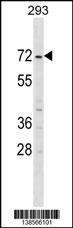 ZNF643 Antibody