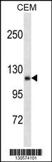 AMOT Antibody