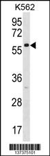 ZNF212 Antibody