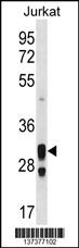 ACER1 Antibody