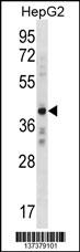 AEBP2 Antibody