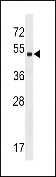 ZNF559 Antibody