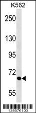 ALS2CR8 Antibody