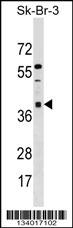 ARMC10 Antibody