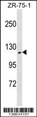ZHX2 Antibody