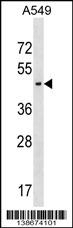 AGPAT5 Antibody