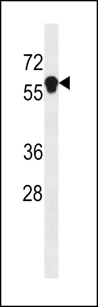 ANKDD1B Antibody