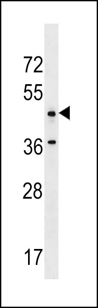 ANKRD61 Antibody