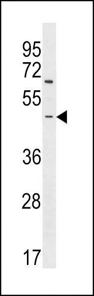 ARHGEF35 Antibody