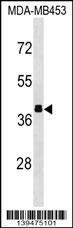 ALDOB Antibody