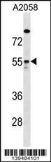 ARHGAP1 Antibody