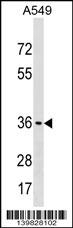 ART5 Antibody