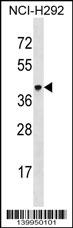 VSIG4 Antibody