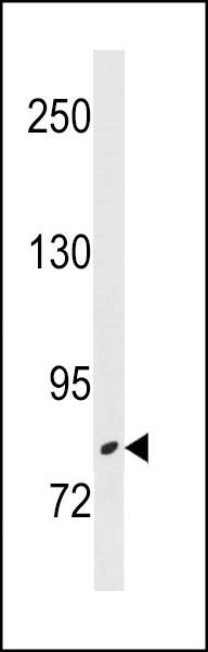 ZBTB17 Antibody